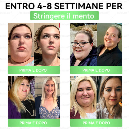 🌍️Negozio ufficiale | 👩‍⚕️ BuildLeaf® GLP-1 8-in-1 Soluzione orale snellente (1 volta al giorno, risultati in 7 giorni). Supporta perdita di peso, cuore, diabete, sonno, intestino, articolazioni, tonifica la pelle e aumenta energia.