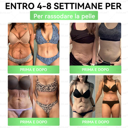 🌍️Negozio ufficiale | 👩‍⚕️ BuildLeaf® GLP-1 8-in-1 Soluzione orale snellente (1 volta al giorno, risultati in 7 giorni). Supporta perdita di peso, cuore, diabete, sonno, intestino, articolazioni, tonifica la pelle e aumenta energia.